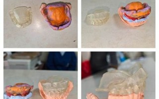 假牙非物质文化遗产（假牙非遗手工技艺有哪些地方传人）