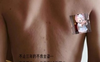 挑羊毛疔非物质文化遗产（挑羊毛疔是国家级非遗吗）