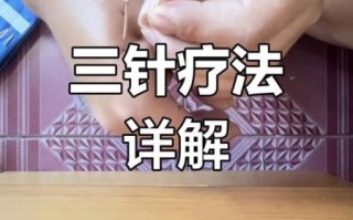 非物质文化遗产扎针（非遗扎针怎么入门：新手从零开始学）