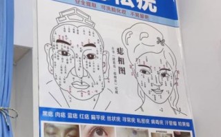 非物质文化遗产痣（非遗点痣技艺是什么）