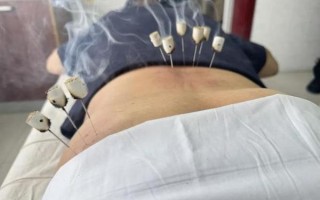 腰椎非物质文化遗产（腰椎非遗推拿有哪些项目）