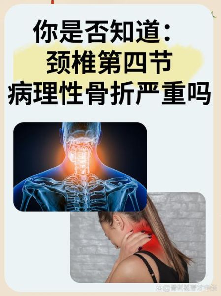颈椎非物质文化遗产是啥（颈椎非物质文化遗产是哪个项目）-第2张图片-八三百科