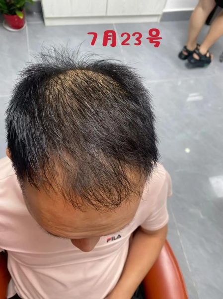 生发非物质文化遗产（生发非遗是真的吗）-第2张图片-八三百科