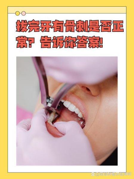 非物质文化遗产拔牙（民间非遗拔牙技艺是否安全）-第1张图片-八三百科