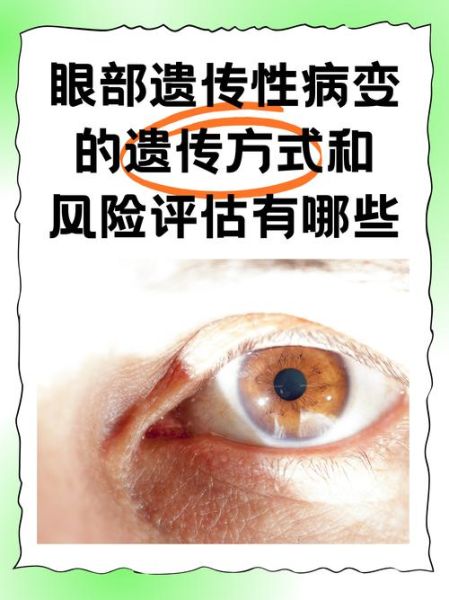 非物质文化遗产马氏眼科（非物质文化遗产马氏眼科治疗近视是真的吗）-第3张图片-八三百科