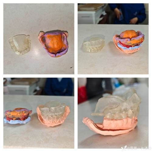 假牙非物质文化遗产(假牙非遗手工技艺有哪些地方传人)-第1张图片-八三百科 假牙非物质文化遗产(假牙非遗手工技艺有哪些地方传人)-第1张图片-八三百科