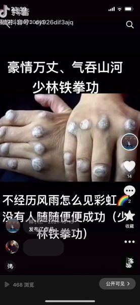 非物质文化遗产少林(少林非遗项目有哪些最新名录2025)-第2张图片-八三百科 非物质文化遗产少林(少林非遗项目有哪些最新名录2025)-第2张图片-八三百科