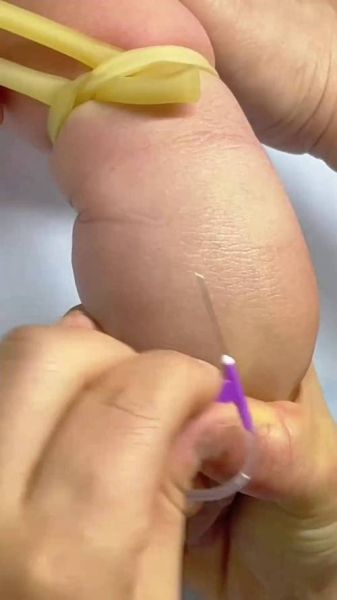 非物质文化遗产扎针（非遗扎针怎么入门：新手从零开始学）-第2张图片-八三百科